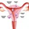 √ Uterus (Rahim) : Pengertian, Fungsi, Struktur dan Bagian Terlengkap