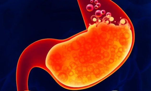 √ Gastritis : Pengertian, Tanda, Gejala, Faktor Penyebab dan Jenis Terlengkap