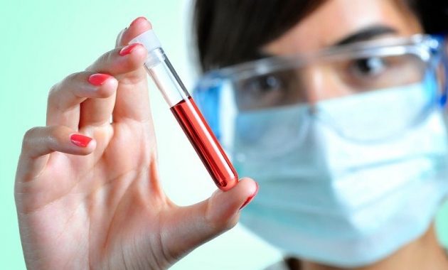 √ Antibodi : Pengertian, Fungsi, Sifat, Jenis dan Struktur Terlengkap