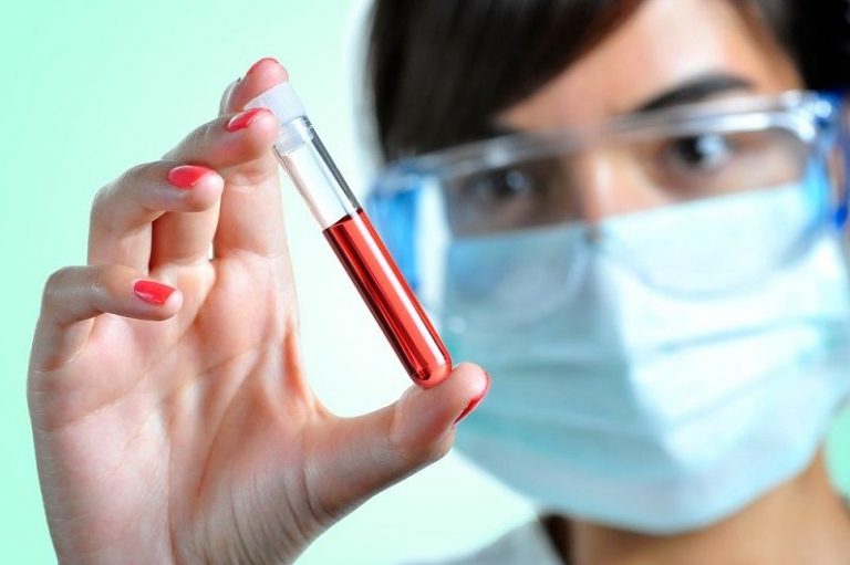 √ Antibodi : Pengertian, Fungsi, Sifat, Jenis dan Struktur Terlengkap