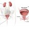 √ Kandung Kemih : Pengertian, Fungsi, Struktur dan Penyakit Terlengkap